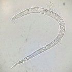 Entomopathogene nematoden – bondgenoten tegen plaaginsecten