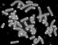 Chromosomen (grijs) van een mens met aan de uiteinde de telomeren (wit) / Bron: U.S. Department of Energy Human Genome Program, Wikimedia Commons (Publiek domein)