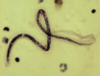 Een volwassen draadworm / Bron: cdc.gov, Wikimedia Commons (Publiek domein)